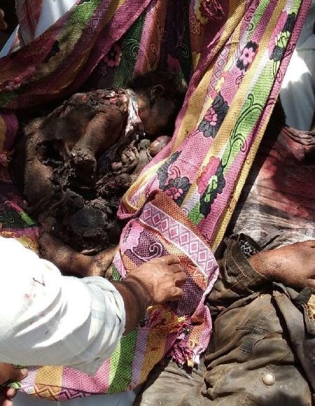 غارات التحالف تغتال الطفولة في اليمن..مشاهد مروعة