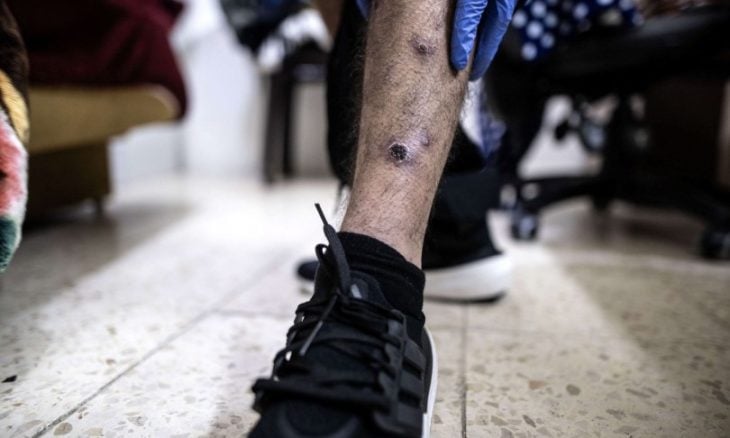 أسرى فلسطينيون يرون تفاصيل مروعة عن وحشية التعذيب داخل السجون الإسرائيلية