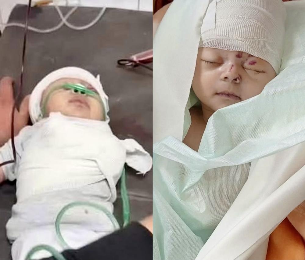 شام رضيعة غزة التي ولدت تحت القصف ورحلت بذراع مبتورة شام رضيعة غزة التي ولدت تحت القصف ورحلت بذراع مبتورة