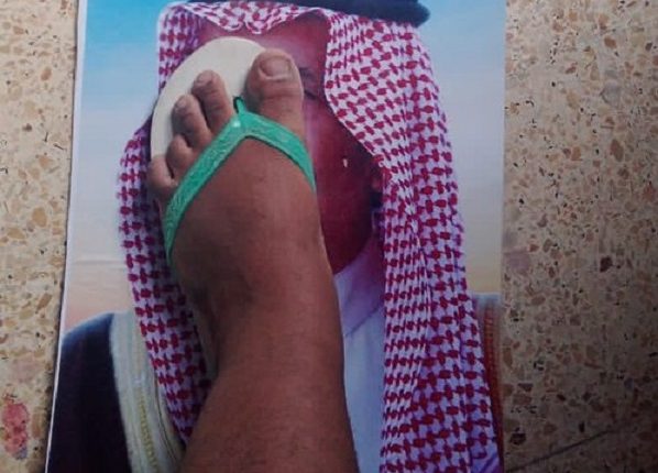 دعس صورة الملك السعودي حضرموت